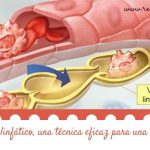 Drenaje linfático, una técnica eficaz para una salud óptima